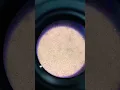 Download Lagu sperm cell under microscope
