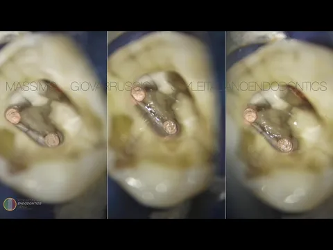 product video thumbnail