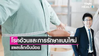 โรคอ้วนคืออะไร และวัดได้อย่างไร