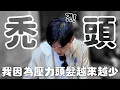 Download Lagu 中年危機！我的頭髮竟然越來越少！【Joeman】