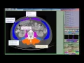 SLICEOMATIC for BODY COMPOSITION ANALYSIS