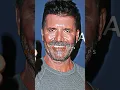 What Happened to Simon Cowell s Face