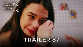 Scars Of The Soul Trailer 87 Alaca English Subtitles 