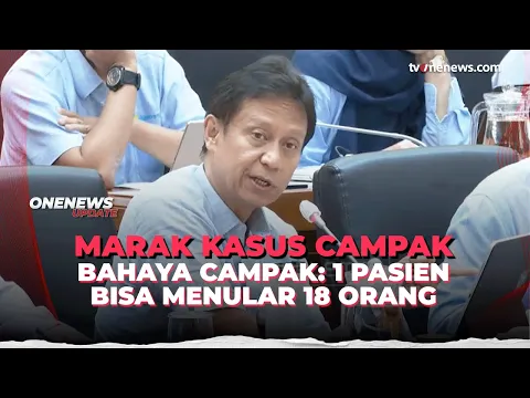 Menkes Sebut Pencegahan Campak Terhalang Antivaksin dan Halal Haram