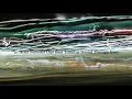Download Lagu 10 Hour Number One Best Tinnitus Sound Therapy Ever Nature Sounds