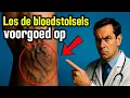 Download Lagu Waarom bloedstolsels ontstaan en hoe je trombose op natuurlijke wijze kunt voorkomen