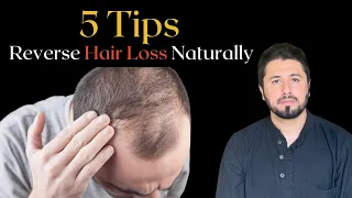 why so many young men bald today and suffer from male pattern baldness