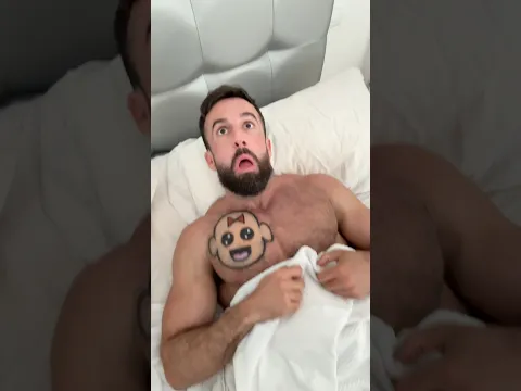 How a Spider Bite Can Change Your Family’s Destiny Forever! #shorts #comedy #funny #humor