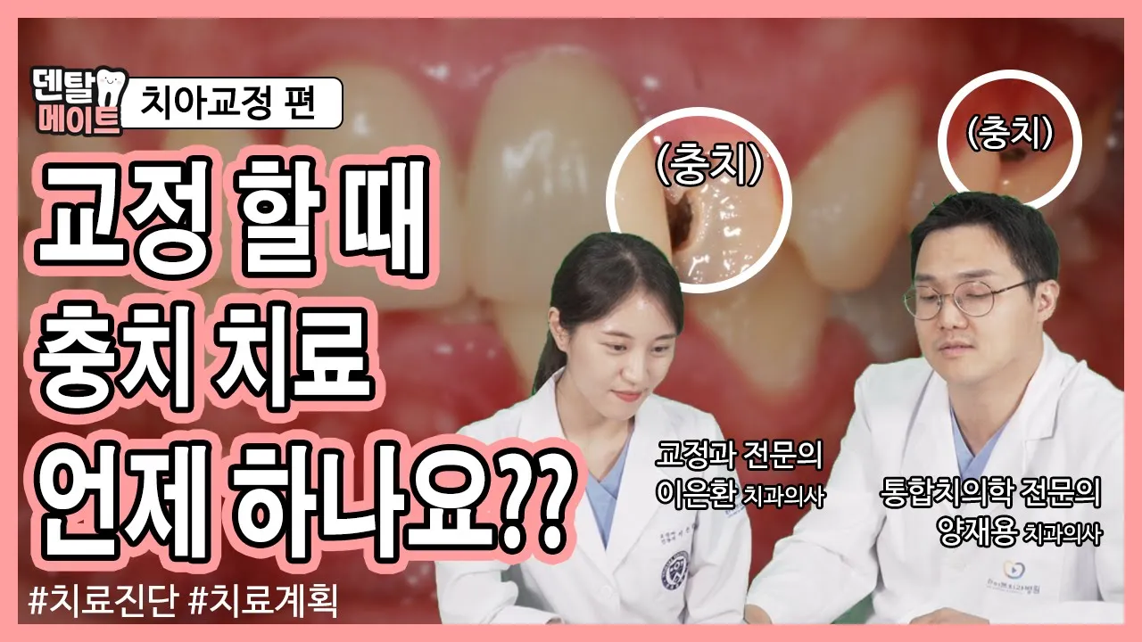 충치가 많은 경우 치아교정 [치료진단, 치료과정, 치료계획] 미리 알아보기 | 덴탈메이트