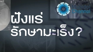 การได้รับรังสีในปริมาณมากเกิดจากเหตุใด และอาจก่อให้เกิดอาการอย่างไร