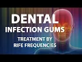 Download Lagu Dental Infection Gums - RIFE Frequencies Treatment - Energy \u0026 Quantum Medicine with Bioresonance
