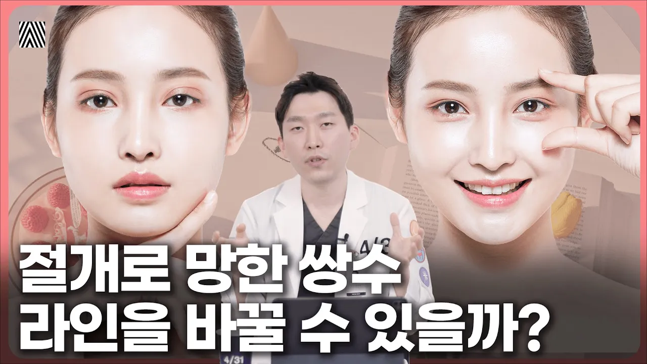 망해버린 쌍꺼풀 수술.. 이런 분들은 완벽하게 교정할 수 있습니다!!_[4월31일 성형외과]