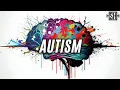 Download Lagu Why is everyone suddenly neurodivergent?