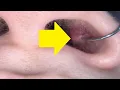 how to get rid of a piercing bump inside your nose fast and easy