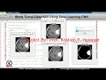 Brain Tumor Detection Using Deep Learning CNN Brain Tumor Segmentation Using Matlab Project Code