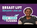 Plastic surgery in Tijuana after Weight loss from New York