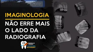 4 Dicas para leitura de região de Radiografias Periapicais | IMAGINOLOGIA