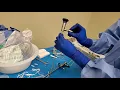 HOW TO SET UP FOR LEFT AND RIGHT STENT PLACEMENT CYSTO