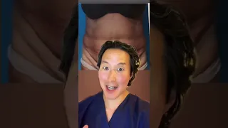 How Does Someone Have Two Butts Doctor Explains