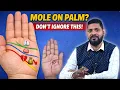 Moles on Palm Lines Hand Good or Bad Palmistry Tips by Dr Sai Suvajit