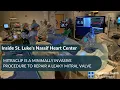 MitraClip is a minimally invasive procedure to repair a leaky mitral valve
