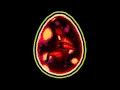 Why the Planula Sucks