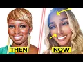 EXPOSING What Happened to NeNe Leakes Face Fans SHOCKED by Her New Unrecognizable Look