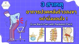  อาการปวดหลังร้าวลงขาอาจเกิดจากสาเหตุอะไรบ้าง 