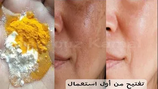 Whitening Forever Stronger Whitening Skin Quickly God And Then God Clear White Skin Catelage 