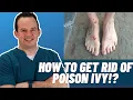 How to get rid of poison ivy Dr Nick Campitelli