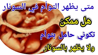 متى يظهر التوأم في السونار هل ممكن اكون حامل بتوام ولا يبين بالسونار متى يبان التوأم في السونار 