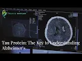 Lagu Tau Protein: The Key to Understanding Alzheimer's