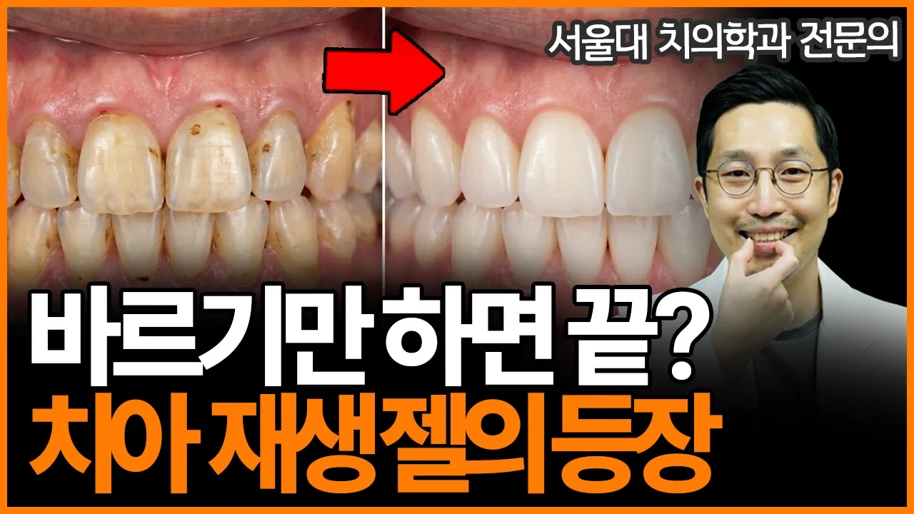 손상된 치아가 회복되는 젤의 등장 — 치과 치료, 이제 달라질까요?