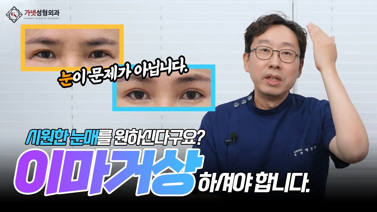 연예인처럼 크고 시원한 눈매를 만드는 방법! 트임이 아니라 이마거상으로 가능하다고?🙂