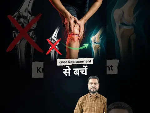 Knee Replacement से बचने के लिए ये 3 गलती छोड़ दें" #physiovedicclinic #kneepain