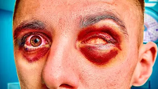 i'm losing both my eyes..