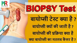 what is biopsy test in hindi why biopsy is done biopsy procedure why is biopsy done