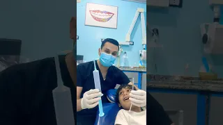 شاهد اكبر حقنة اسنان في العالم طفل شجاع لا يخاف من حقنة بنج الأسنان Dr Abdullah Sultan Dentist 