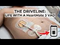 Spend A Day With Me on Life Support LVAD Heartmate 3