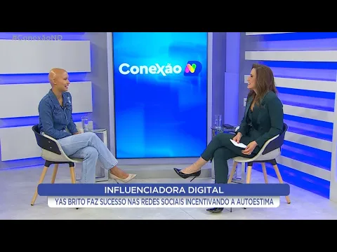 Conexão ND recebe a modelo com alopecia, Yas Brito