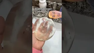 How Do You Get Mold Inside Breast Implants