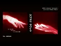 GORDO & Reinier Zonneveld - Loco Loco (Maddix Remix) - [ T0+ REMAKE ]