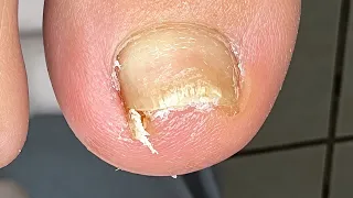 😱 Espícula ponteaguda #nails #satisfying