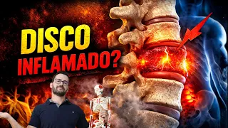 Disco Inflamado na Coluna? O ERRO que Mantém a Dor Ativa - FisioPrev