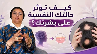 الامراض الجلدية النفسية وكيف تتعافي منها 