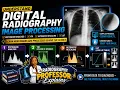 Digital Radiography Processing Histogram VOI Rescaling and LUT