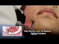 Download Lagu Erase Scars, Wrinkles \u0026 Sun Damage | The Power of CO2 Fractional Laser