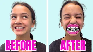 High School Teen Gets a BIG Teeth Surprise!