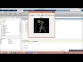 Implementation of Edge detection techniques in Matlab