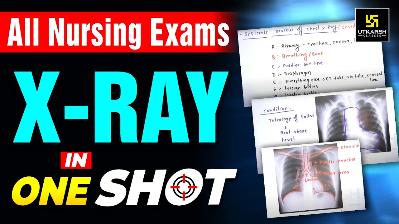 X-Ray in One Shot | Important for All Nursing Exams | Utkarsh Nursing Classes